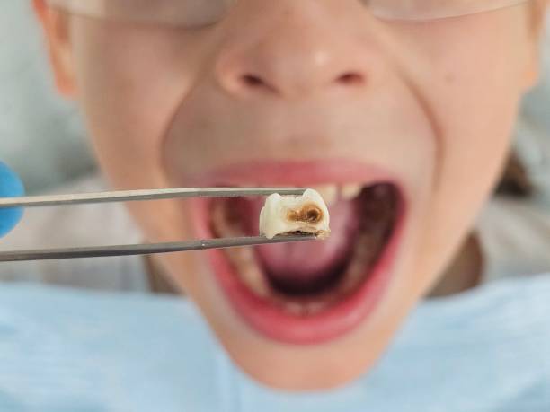 Best Urgent Care for Lost Fillings or Crowns in Williamson, WV